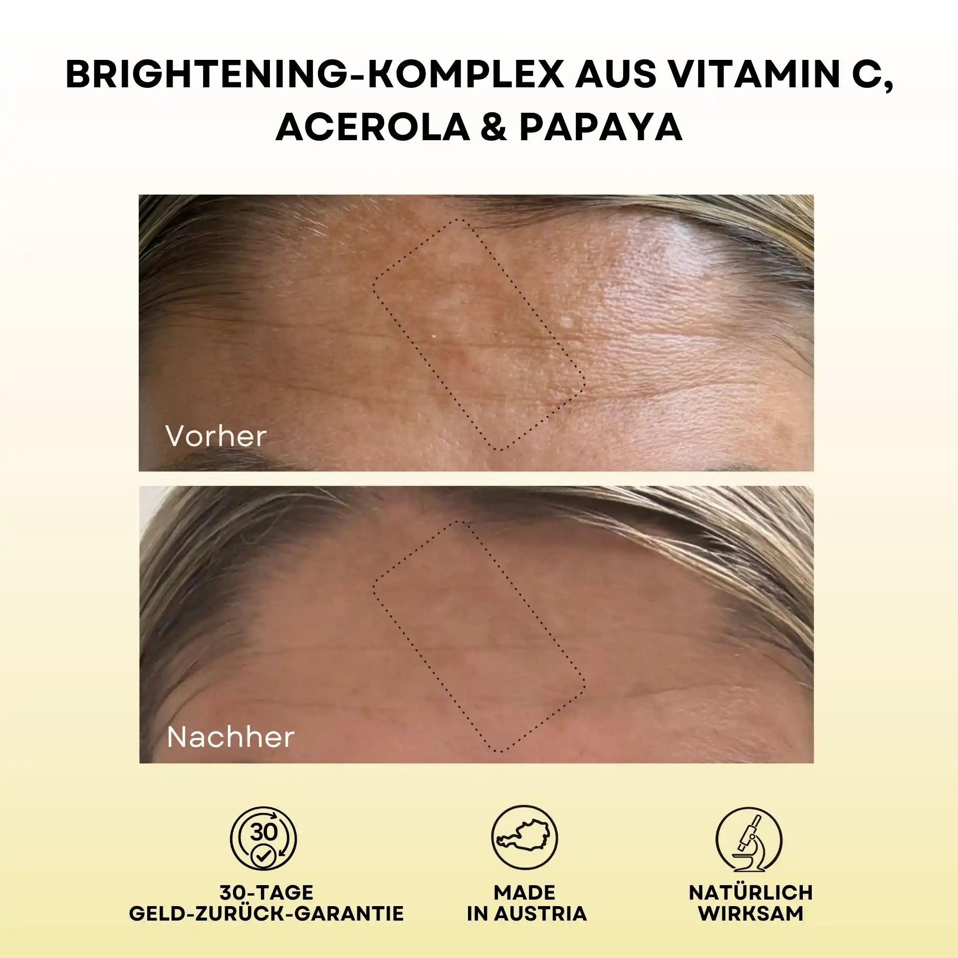 Pigmentflecken Lösungsset